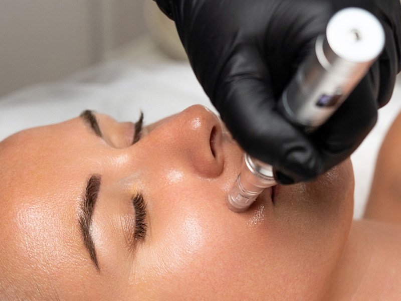 Min-ChequeRegalo-kiss-EXOSOMAS